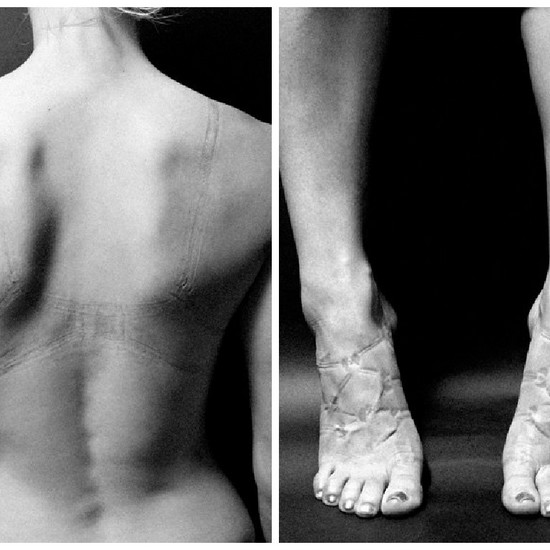 9 фотографий следов на женском теле, которые документируют наши каждодневные страдания за красоту