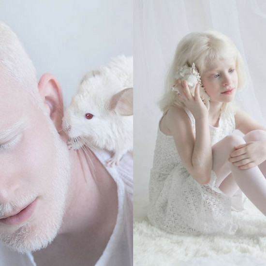 Альбинос - фарфор, гипнотизирующая красота, захваченная на фотографиях