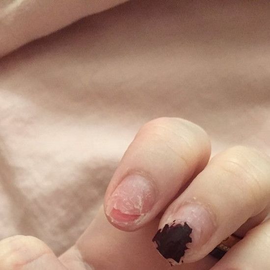 Блоггер показал, что ногти разрушены на акриле - это очень больно!