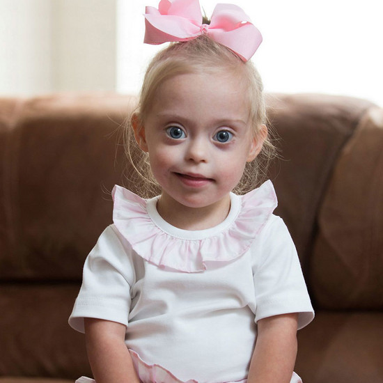 Ей 2 года, синдром Дауна и является моделью. Трудно не влюбиться в ее глаза