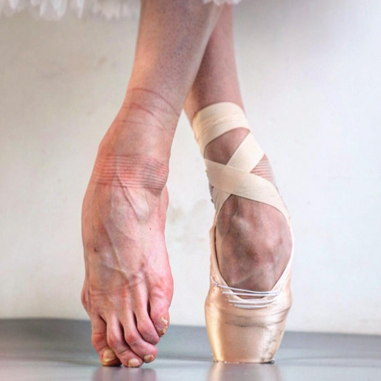 Фотограф показывает настоящий балет - его красоту на сцене, но и раны, которые танцуют с телом