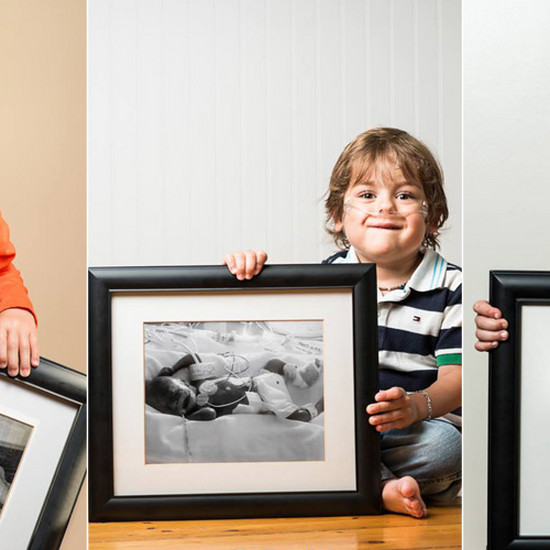 Фотографии недоношенных детей сразу после рождения и несколько лет спустя. Их рассказы дают надежду