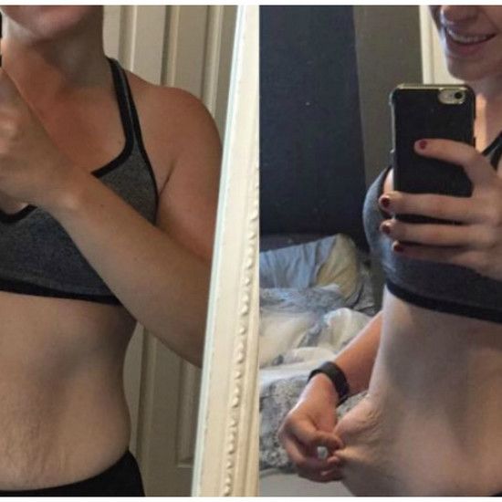 Эта женщина показала, что случилось с ее кожей после потери 40 килограммов