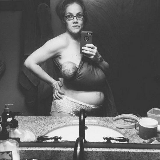 Это мое тело через 24 часа после рождения: послеродовой SELFOE, и в письме показаны яркие и темные стороны материнства