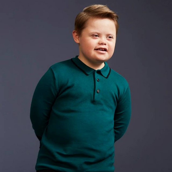 Мальчиком с синдромом Дауна стала модель. Инвалидность не определяет его, он обычный человек