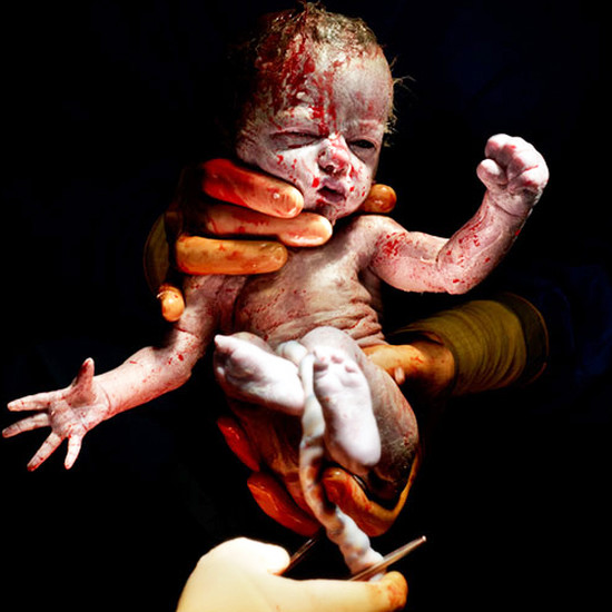 Когда жизнь проходит всего несколько секунд: необычные фотографии детей сразу после рождения