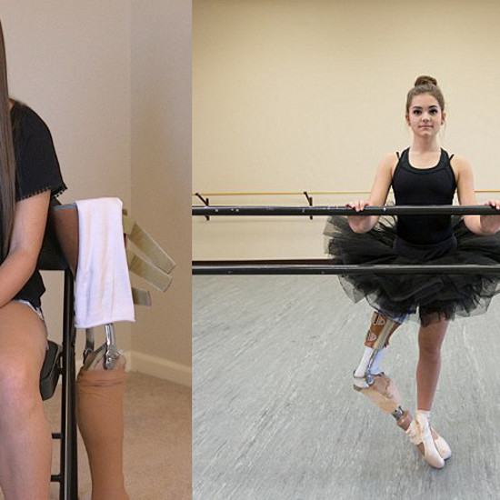 Нога была ампутирована этим подростком, и все же она стала балериной