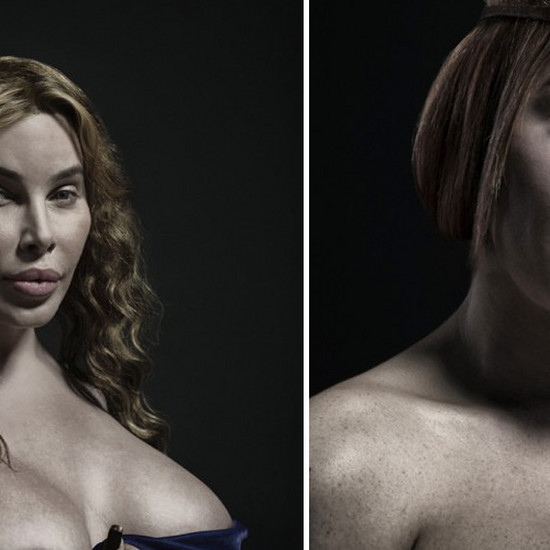 Новый канон красоты нашего времени? 12 фотографий людей после экстремальной пластической хирургии