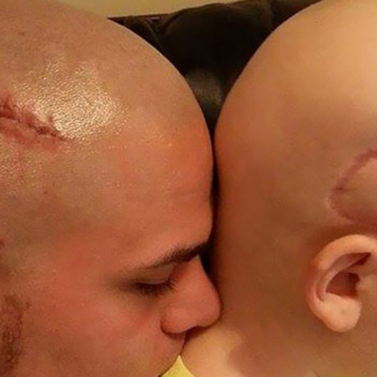 Отец не позволял своему сыну бороться со сложной болезнью и ... он татуировал тот же шрам на голове
