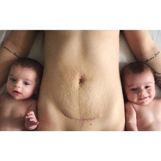 Подросток-мама показывает тело через 4 месяца после рождения - я горжусь собой