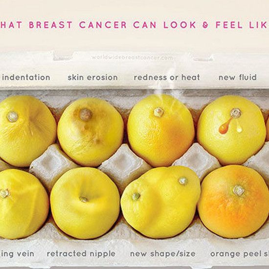 Познакомьтесь с лимонами. Блестящая кампания показывает, как распознать рак молочной железы невооруженным глазом