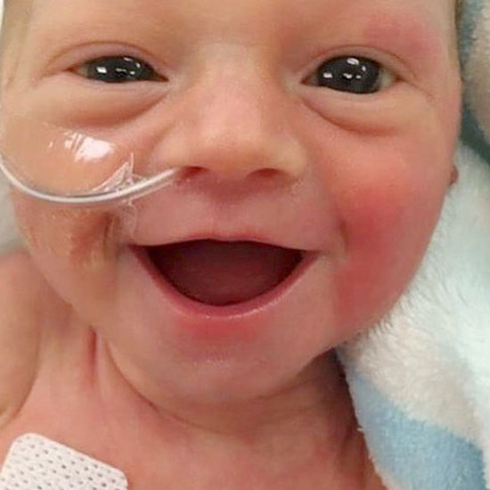 Недоношенный ребенок, через 5 дней после рождения, улыбается от уха до уха. Он счастлив, что жив.