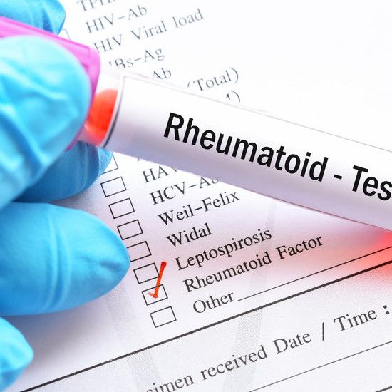 РЧ-тест или ревматоидный фактор