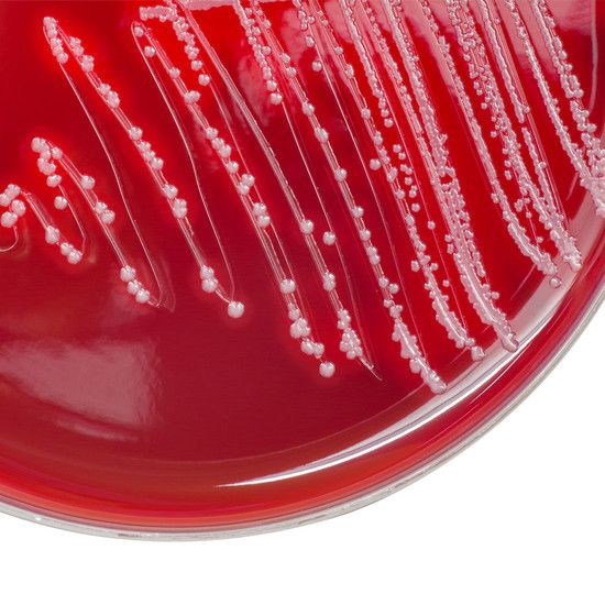 Streptococcus - бактерия, которая вызывает серьезные последствия