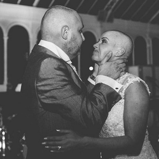 Во время свадьбы она побрила голову, чтобы поддержать мужа, который страдал от рака. Вы не можете быть равнодушны к этим фотографиям!